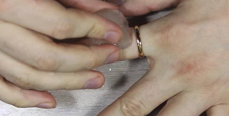 Как снять обручальное кольцо с отекшего пальца