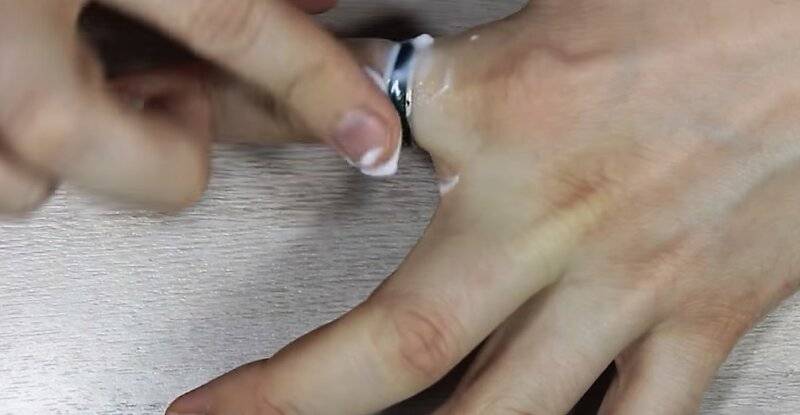 Как снять кольцо с отекшего пальца