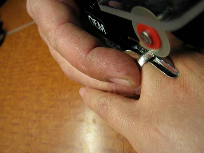 Несколько способов, как снять обручальное кольцо с отекшего пальца
