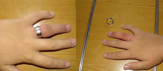 Как снять кольцо с пальца ниткой, без нитки, в сервисе? способы снять кольцо с опухшего пальца